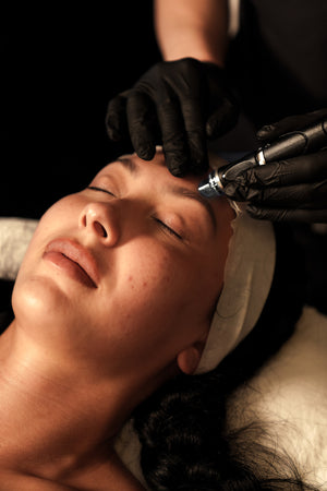 Person receiving a cosmetic procedure on their face with a gloved hand holding equipment.