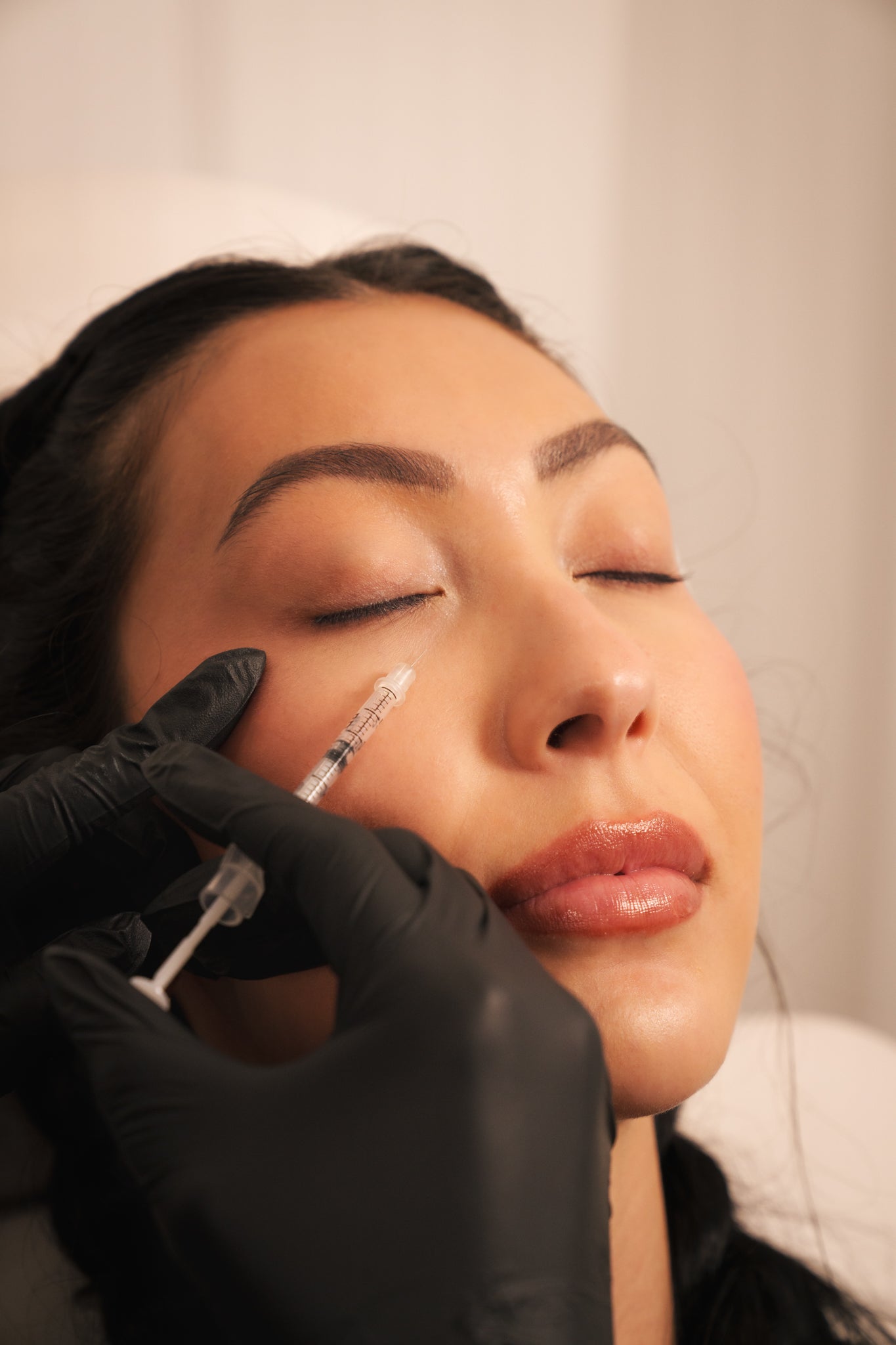 Under Eye Filler