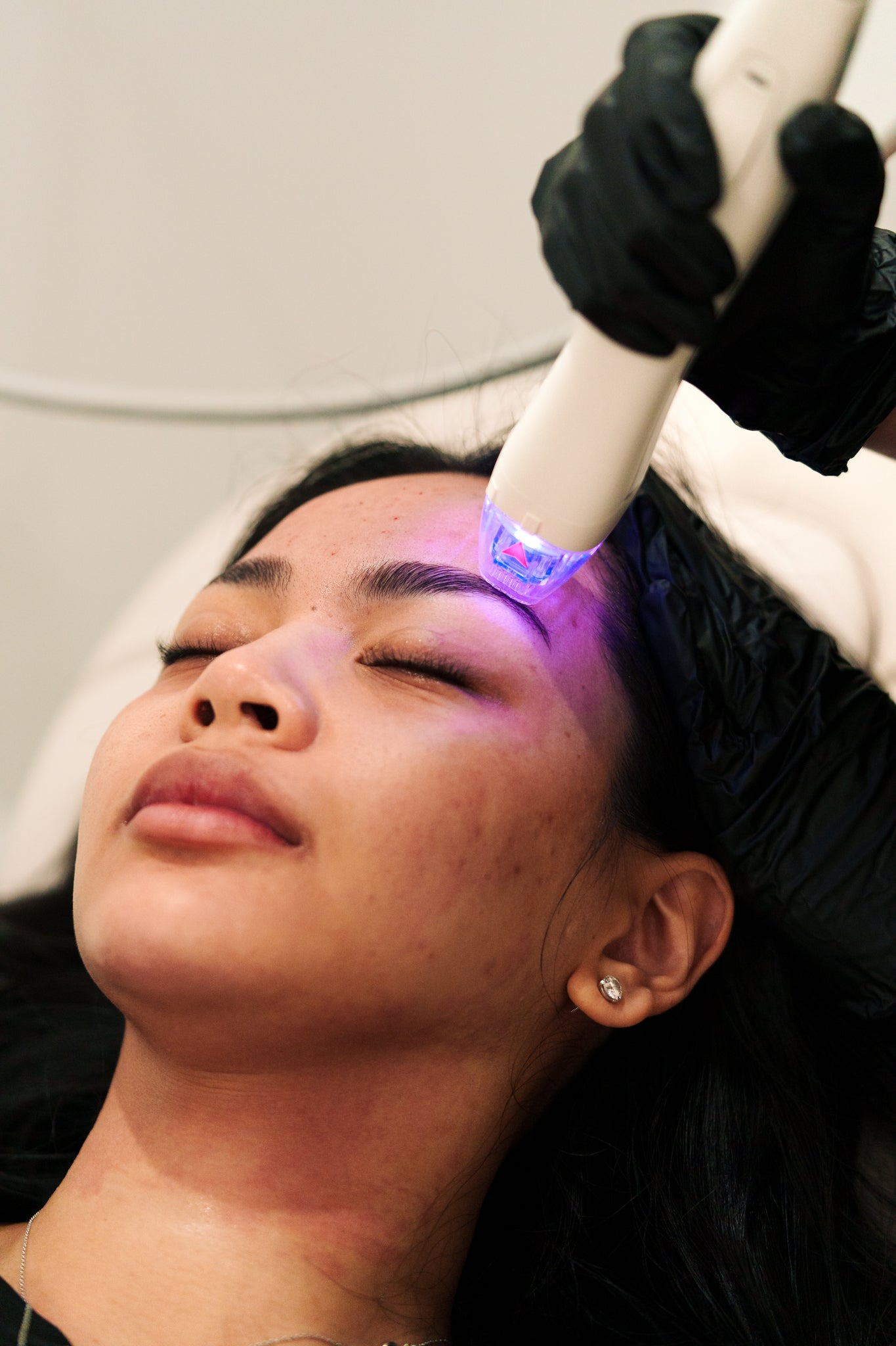 Best Santa Ana Skin Care Clinics: Your 2026 Guide to Treatments, Costs & Results