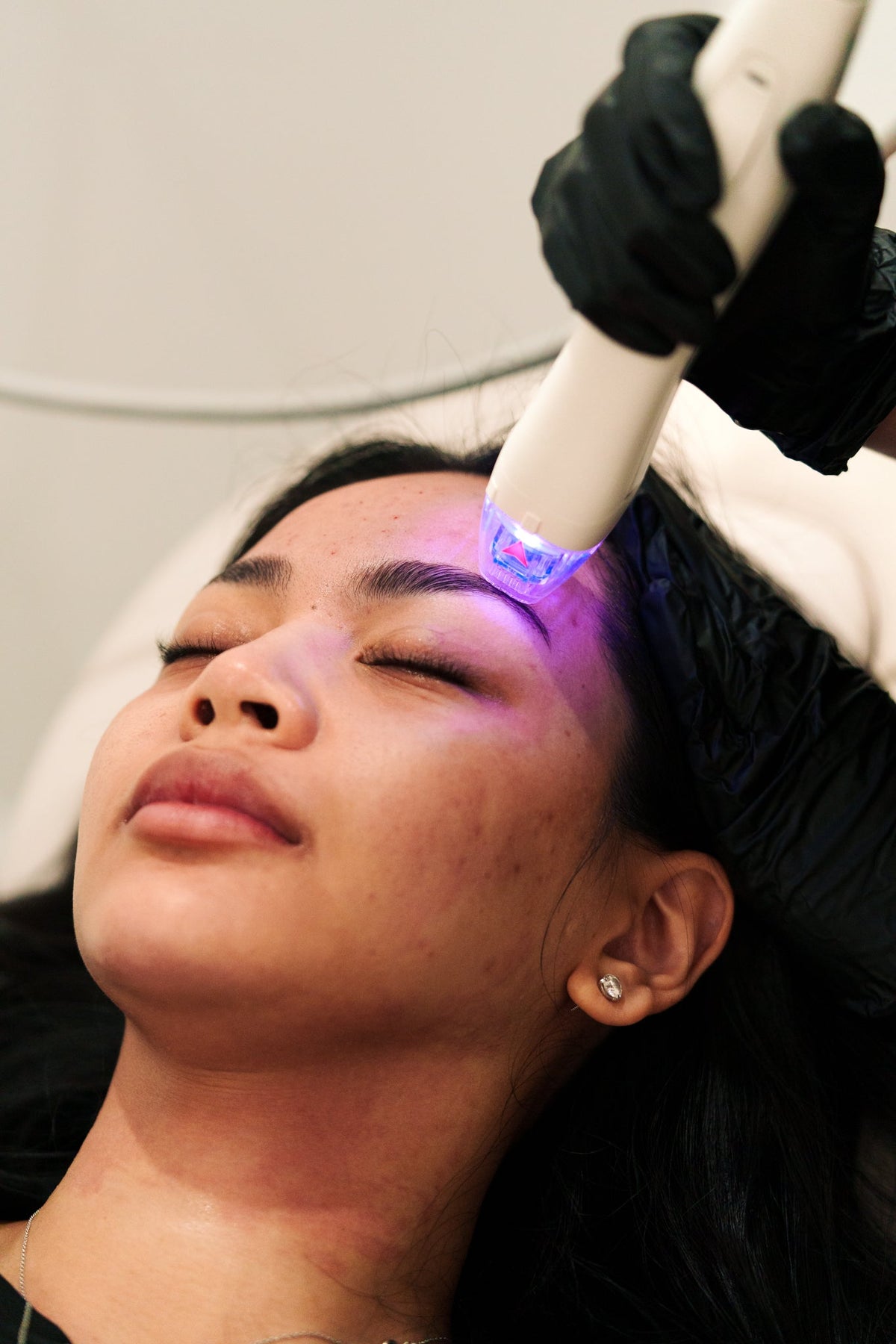 Best Santa Ana Skin Care Clinics: Your 2026 Guide to Treatments, Costs & Results