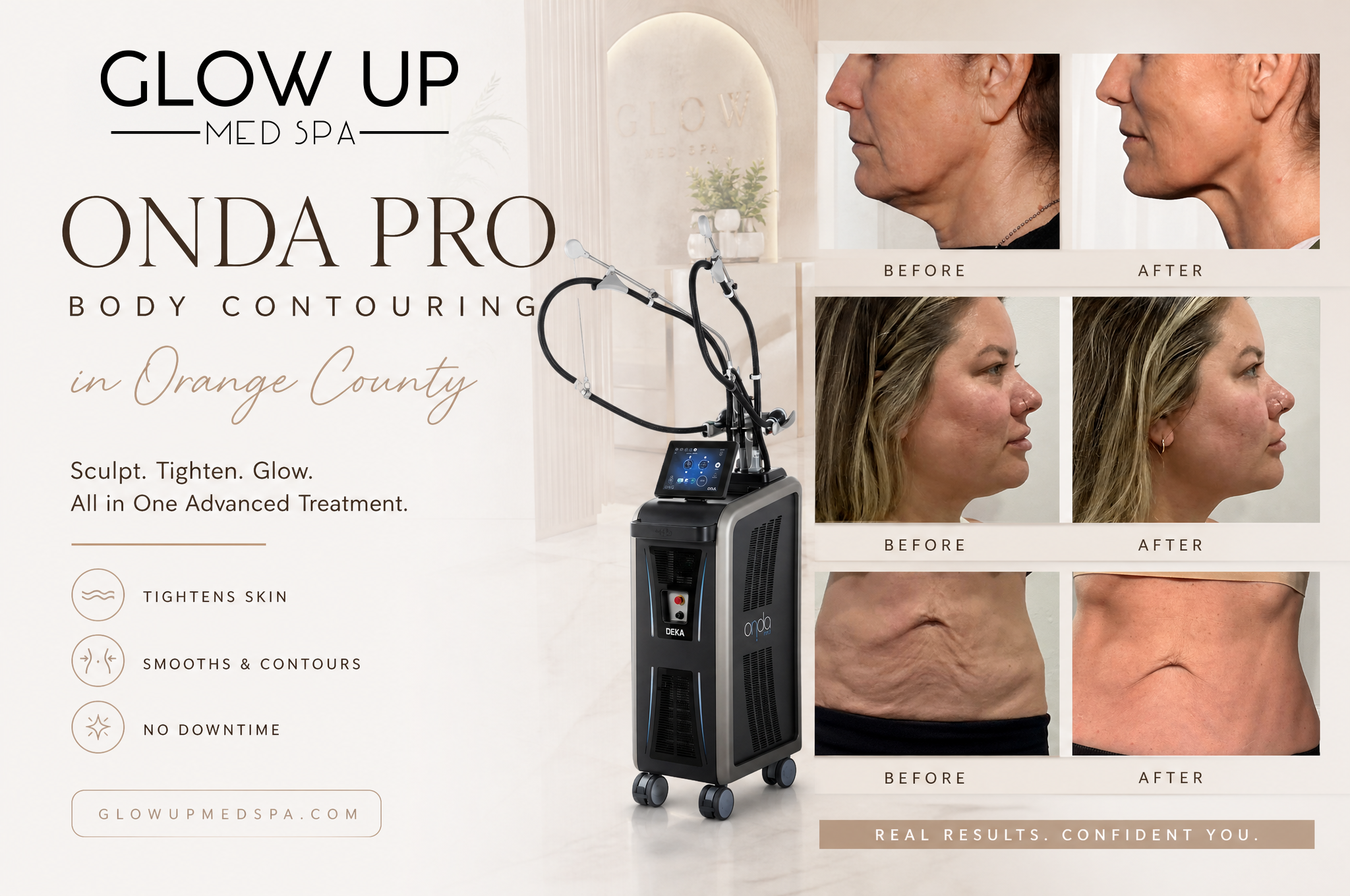 Best Non-Invasive Body Contouring in Orange County (2026) | ONDA Pro vs CoolSculpting vs EmSculpt Compared