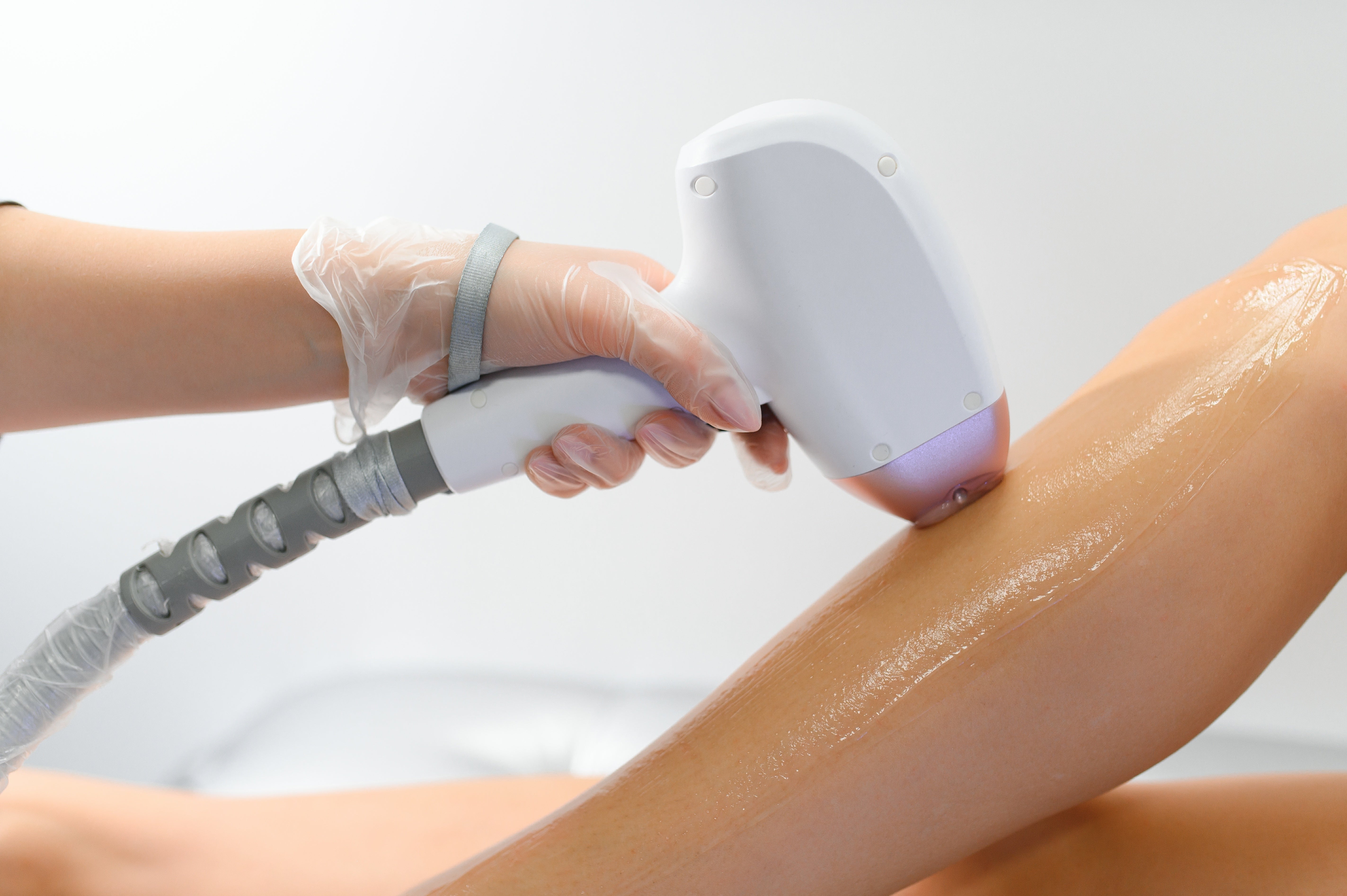 Laser Hair Removal Cost in Orange County (2025)