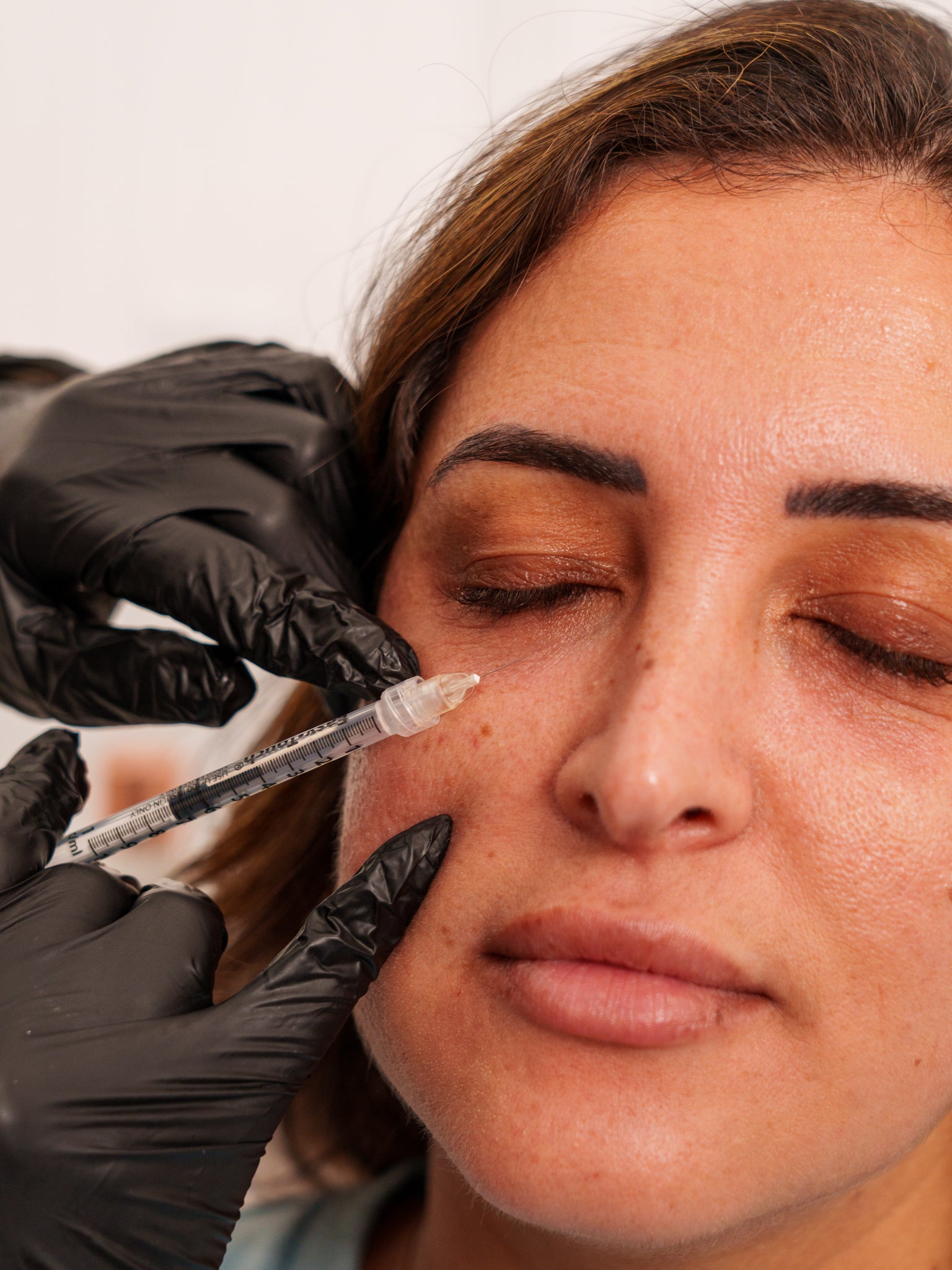 Under Eye Filler