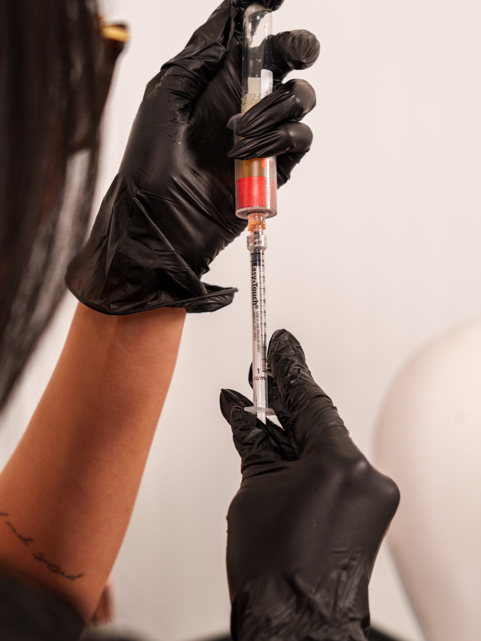 PRFM Injections