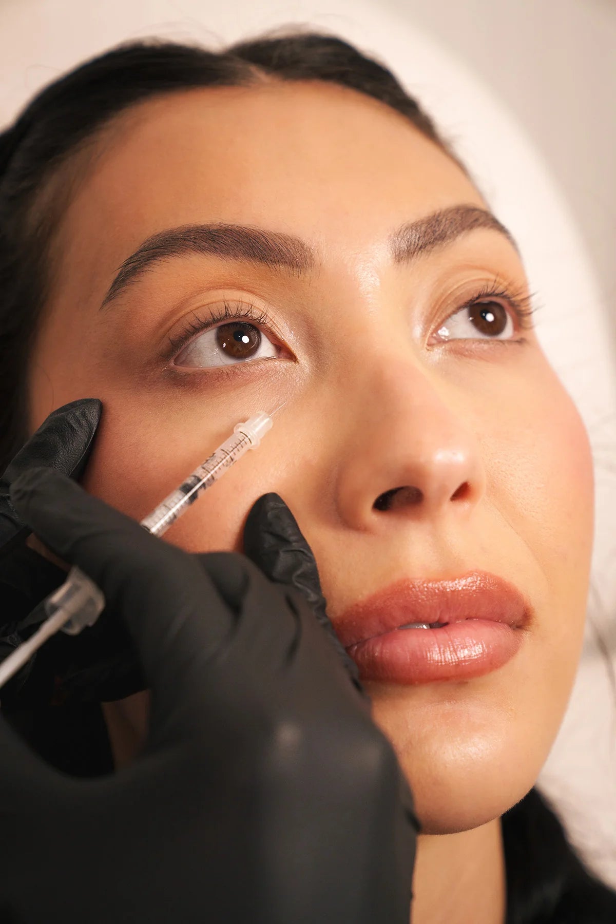 Patient receiving PRFM platelet rich fibrin matrix injection for natural facial rejuvenation Orange County