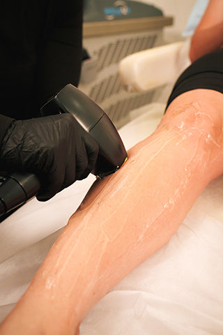 Person receiving laser hair removal treatment on their leg.