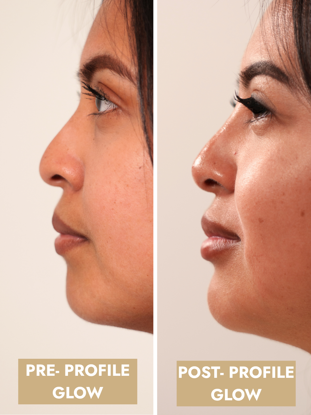 Facial Balancing
