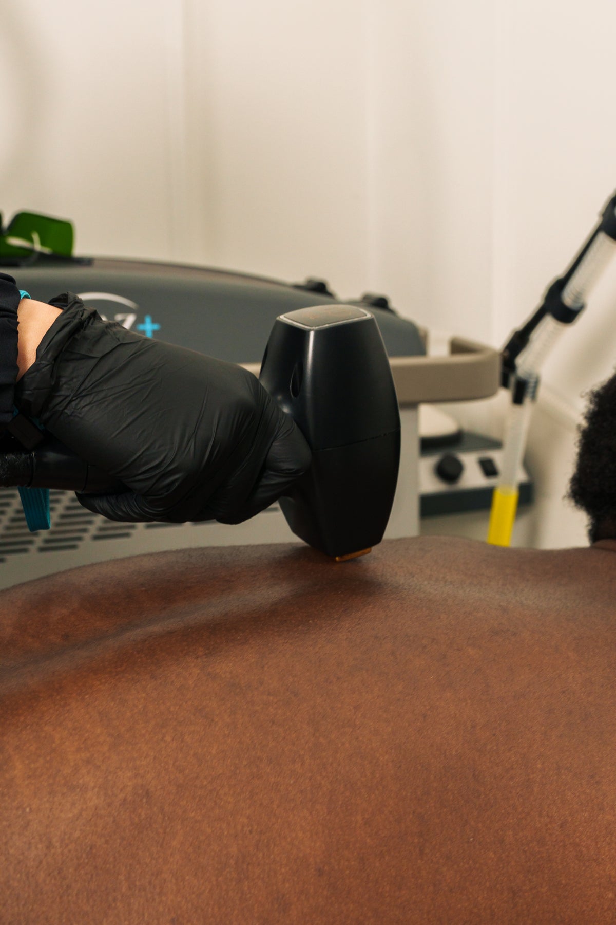 Laser Hair Removal