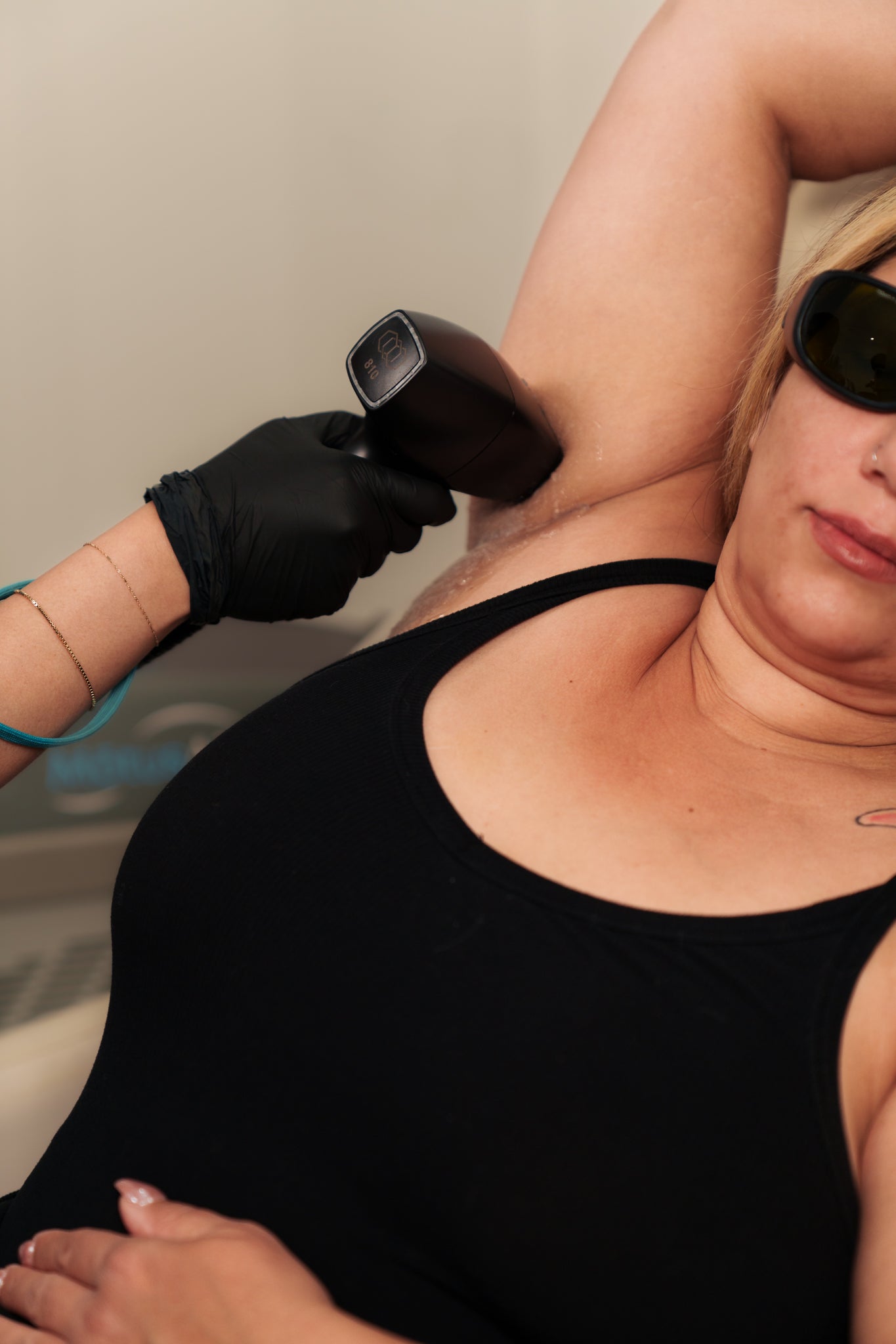 Laser Hair Removal